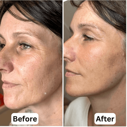 Anti-Aging Repair Serum